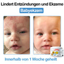 Venom Essense (Remove verrugas, clareia manchas e alivia a psoríase enquanto transforma sua pele de forma rápida e segura)