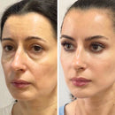 LiftRenew Bastão de Cuidado Rejuvenescedor  Tudo-em-Um