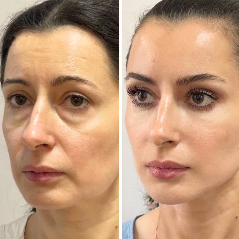 LiftRenew Bastão de Cuidado Rejuvenescedor  Tudo-em-Um