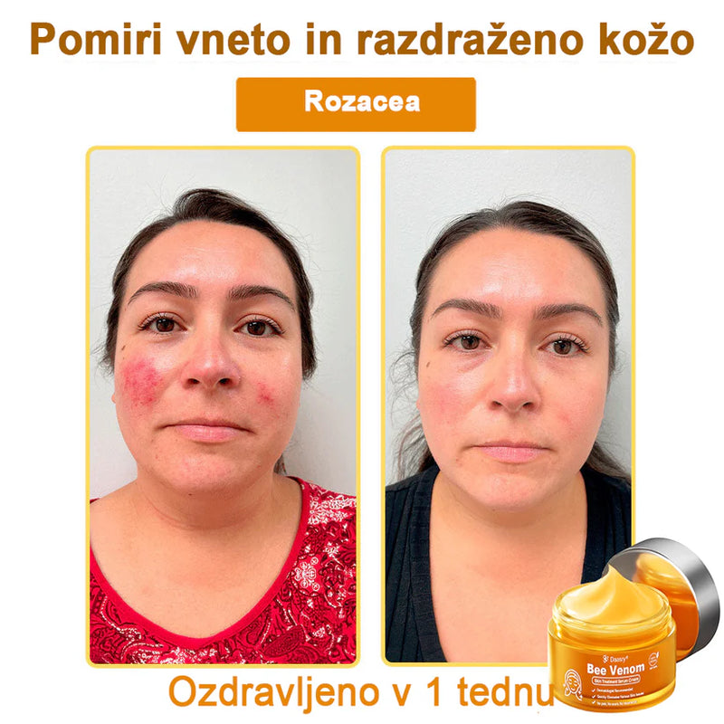 Creme Sérum Terapêutico para a Pele com Veneno de Abelha Daasry