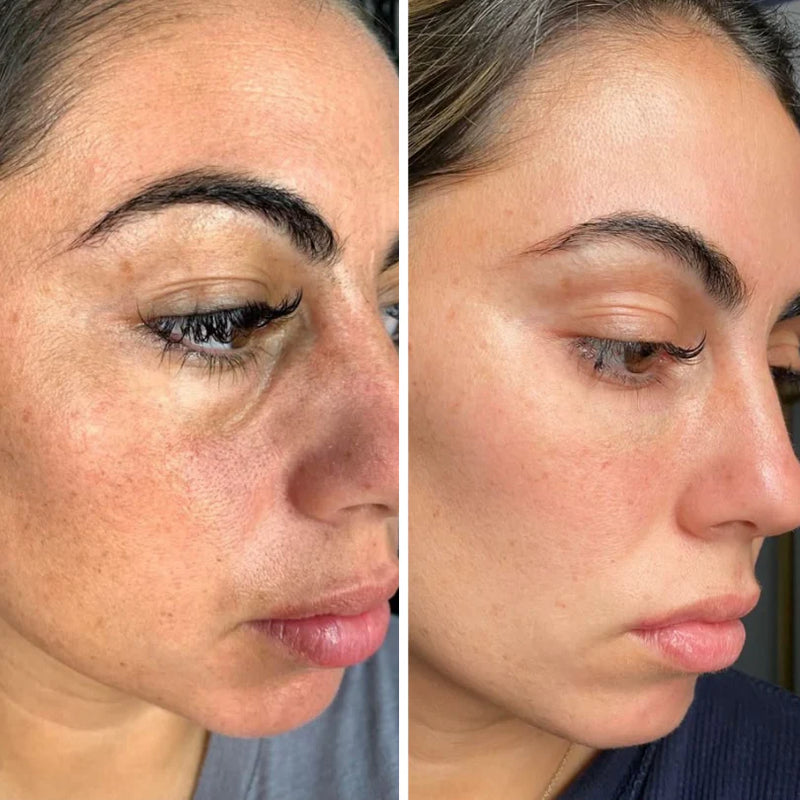 LiftRenew Bastão de Cuidado Rejuvenescedor  Tudo-em-Um