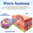 Creme BeeDerm RX | Cuidado suave e direcionado para verrugas, acrocórdons, caroços, infecções, cistos e cicatrizes
