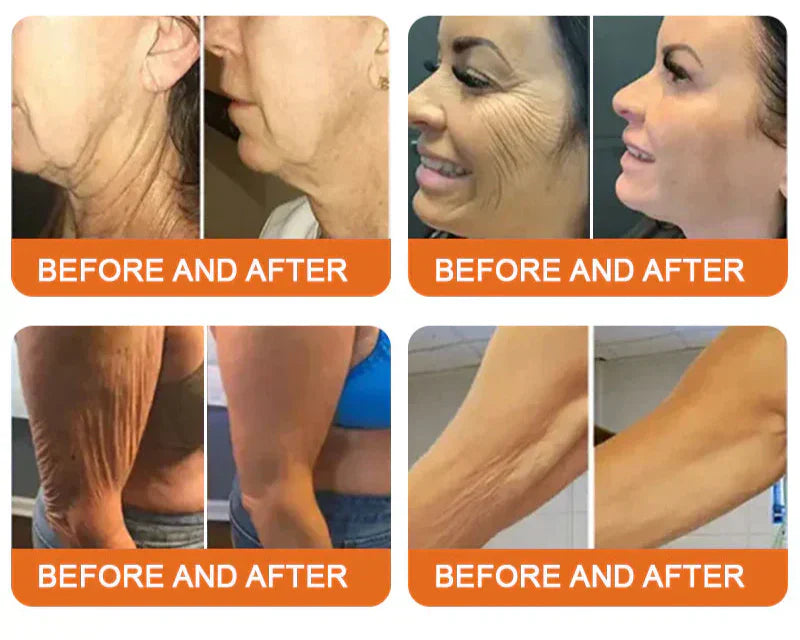 Bastão Botox Bee | Rejuvenescedor
