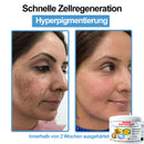 Venom Essense (Remove verrugas, clareia manchas e alivia a psoríase enquanto transforma sua pele de forma rápida e segura)