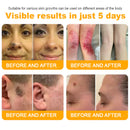 Bee Remove | Creme Reparador para Remoção de Verrugas com Veneno de Abelha