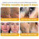 Bee Remove | Creme Reparador para Remoção de Verrugas com Veneno de Abelha