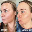 Skin Lumina | Sérum Rejuvenescedor