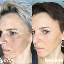 MelantraX Radiance | Sérum Anti-idade