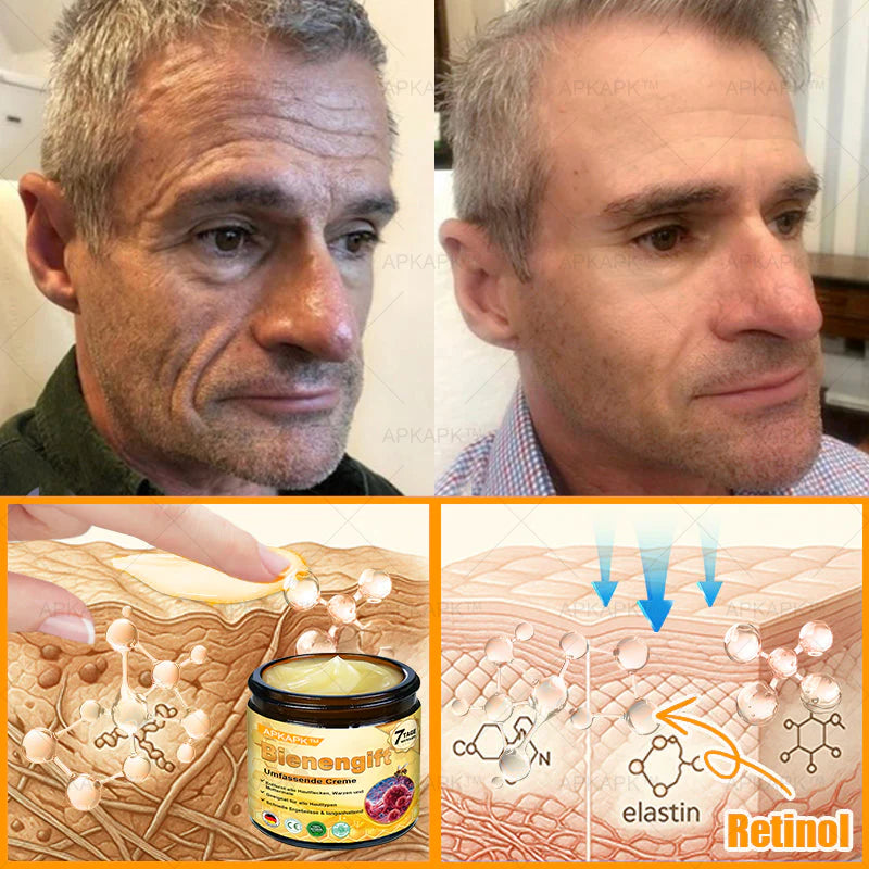 Royal Cream com Veneno de Abelha – Antienvelhecimento