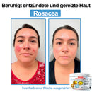 Venom Essense (Remove verrugas, clareia manchas e alivia a psoríase enquanto transforma sua pele de forma rápida e segura)