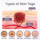 Sérum WartSmooth (Remove verrugas, clareia manchas e alivia a psoríase enquanto transforma sua pele de forma rápida e segura) (Cópia)