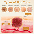 Spray de Remoção de Verrugas BeeVenom