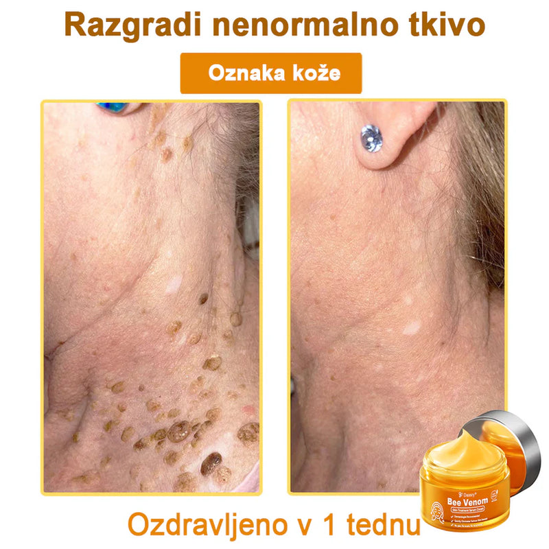 Creme Sérum Terapêutico para a Pele com Veneno de Abelha Daasry