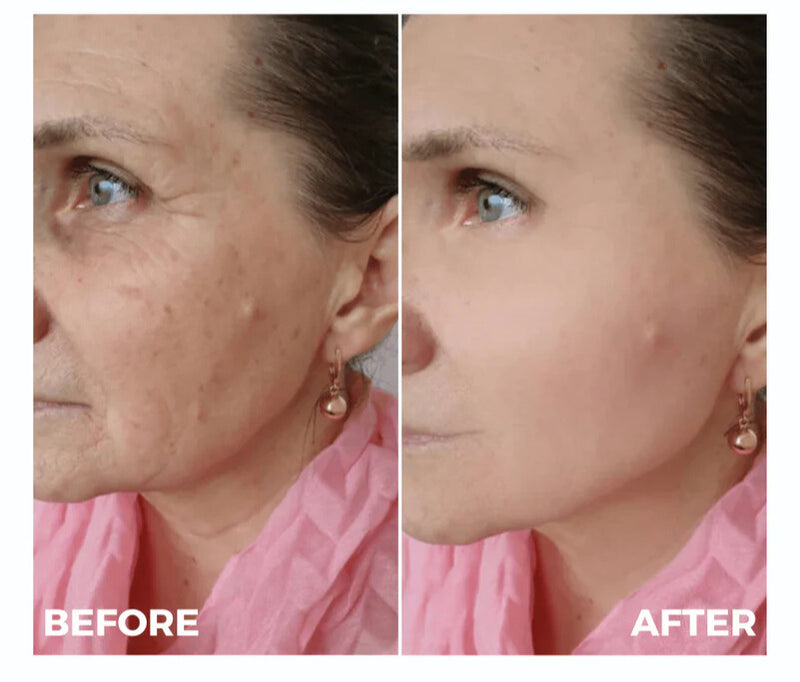 NanoSilka Collagen | Antienvelhecimento