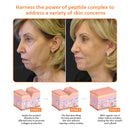 Creme Removedor de Rugas Botox Lifting