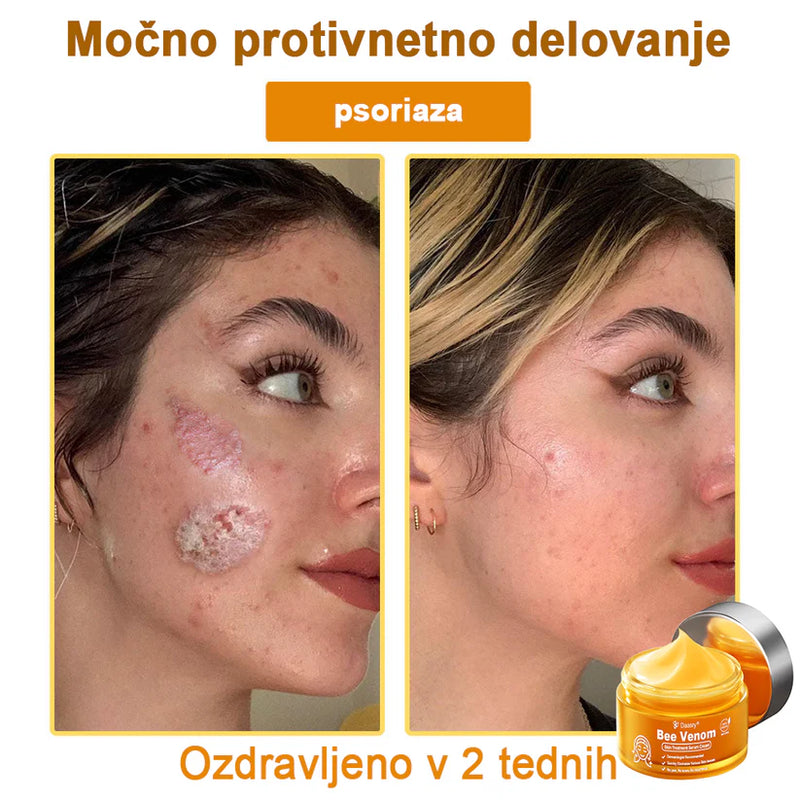 Creme Sérum Terapêutico para a Pele com Veneno de Abelha Daasry