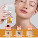 Spray de Remoção de Verrugas BeeVenom