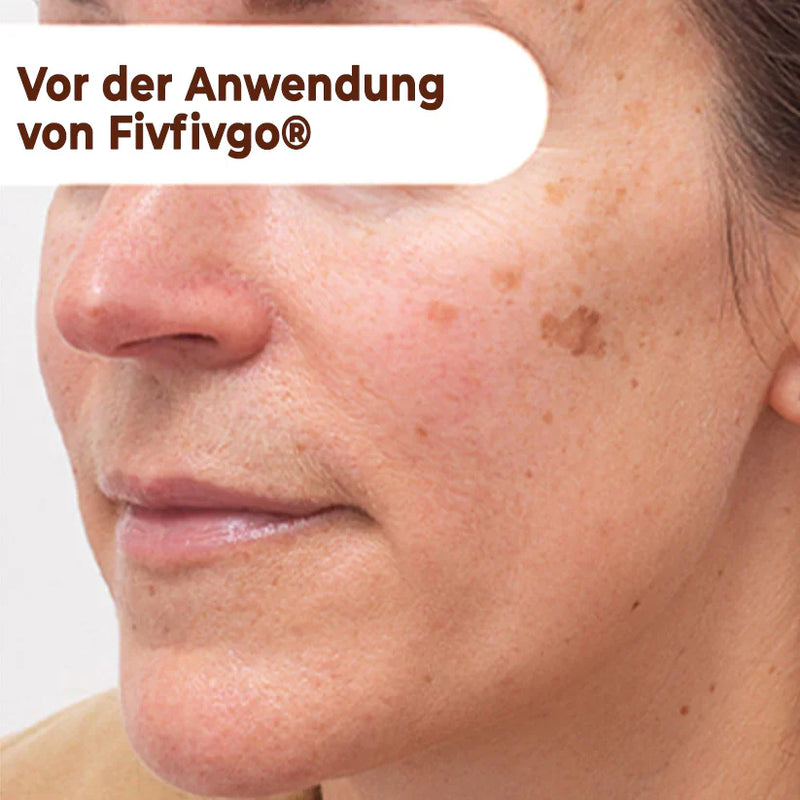 Peelof Derm | Máscara Facial