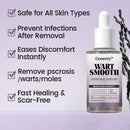 Sérum WartSmooth (Remove verrugas, clareia manchas e alivia a psoríase enquanto transforma sua pele de forma rápida e segura) (Cópia)