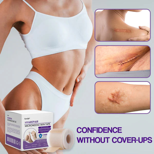 Mikroigelni | Fita Cicatrizante