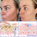 Jorondy Milk Cream | Firmador de Pele