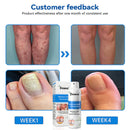 Spray Herbal (Remove verrugas, clareia manchas e alivia a psoríase enquanto transforma sua pele de forma rápida e segura)