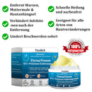 DermaVenom RX+ (Creme de remoção de verrugas e pinstas)