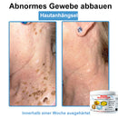 Venom Essense (Remove verrugas, clareia manchas e alivia a psoríase enquanto transforma sua pele de forma rápida e segura)