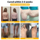 Zentheca BeeThera | Alívio para ossos e articulações com infusão de veneno de abelha