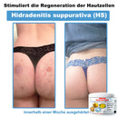 Venom Essense (Remove verrugas, clareia manchas e alivia a psoríase enquanto transforma sua pele de forma rápida e segura)