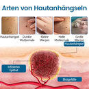 DermaVenom RX+ (Creme de remoção de verrugas e pinstas)