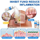 Spray Herbal (Remove verrugas, clareia manchas e alivia a psoríase enquanto transforma sua pele de forma rápida e segura)