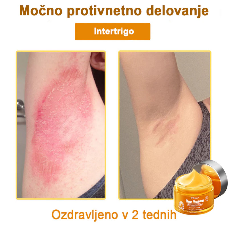 Creme Sérum Terapêutico para a Pele com Veneno de Abelha Daasry