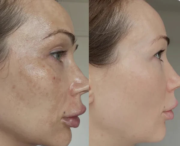 MelantraX Radiance | Sérum Anti-idade