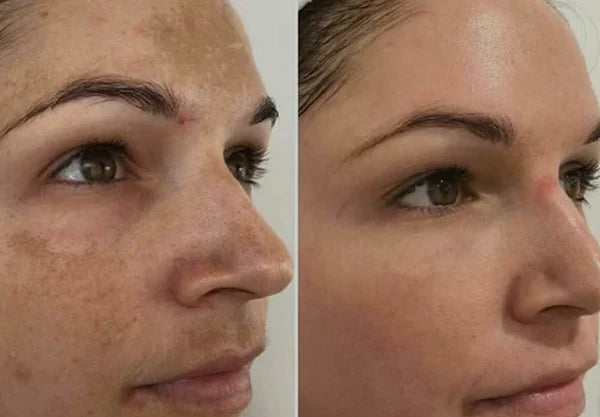 MelantraX Radiance | Sérum Anti-idade