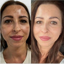 MelantraX Radiance | Sérum Anti-idade