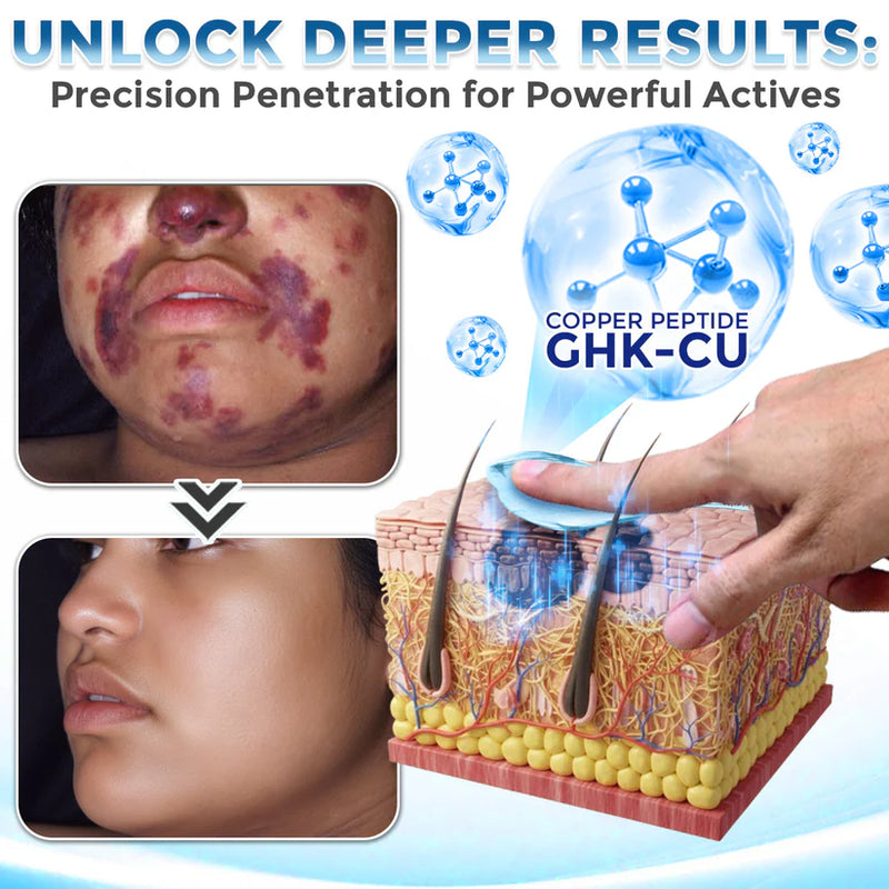 Creme Abrangente de Peptídeo de Cobre GHK-Cu GFOUK®