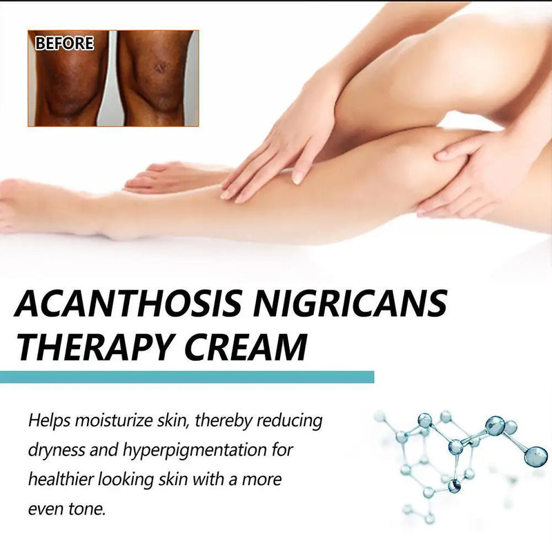 DarkSpot Eraser | Creme Rejuvenescedor
