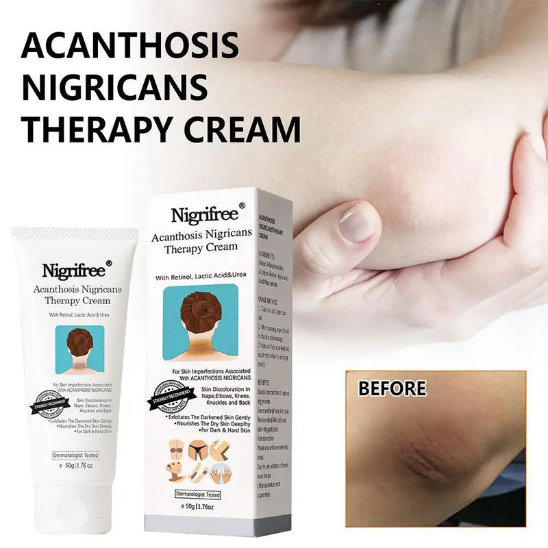 DarkSpot Eraser | Creme Rejuvenescedor