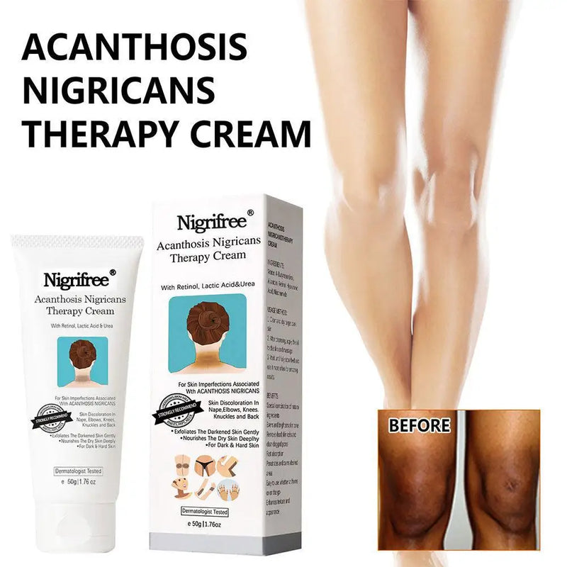 DarkSpot Eraser | Creme Rejuvenescedor