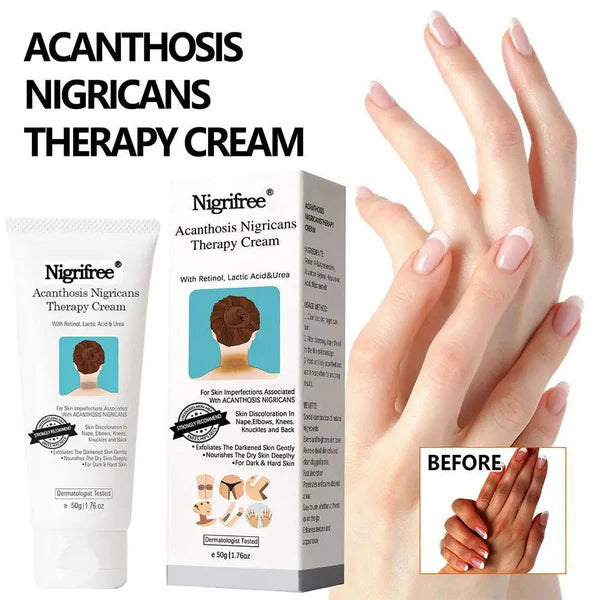 DarkSpot Eraser | Creme Rejuvenescedor