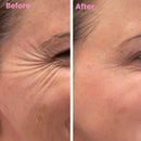 DermaSil | Fita Cicatrizante