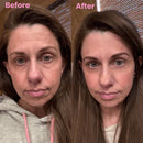 DermaSil | Fita Cicatrizante