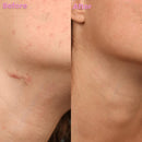 DermaSil | Fita Cicatrizante