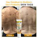 Bee Remove | Creme Reparador para Remoção de Verrugas com Veneno de Abelha