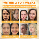 Royal Cream (Hidratação Profunda, combate rugas, flacidez, estrias, manchas escuras, púrpura, inflamações e muito mais.)