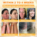 Royal Cream (Hidratação Profunda, combate rugas, flacidez, estrias, manchas escuras, púrpura, inflamações e muito mais.)