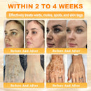 Royal Cream (Hidratação Profunda, combate rugas, flacidez, estrias, manchas escuras, púrpura, inflamações e muito mais.)