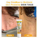 Bee Remove | Creme Reparador para Remoção de Verrugas com Veneno de Abelha